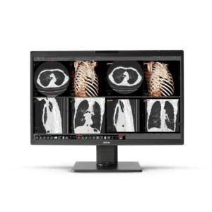MDNC‑8132 Nio Color Monitor de diagnóstico 8MP 32" BARCO